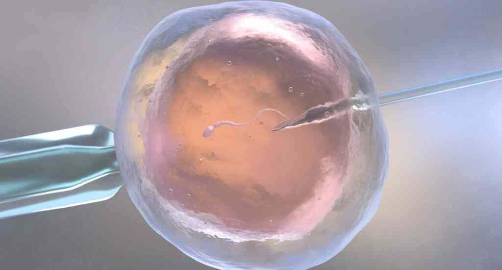 הפריה של ביצית IVF