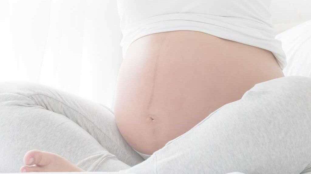 "פס שחור" פיגמנטציה על הבטן בזמן ההריון